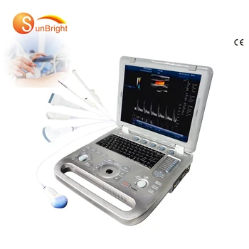 2d 3d 4d echographie farebný doppler lekárske OB obrázok systém pre diagnostiku portable prenosný ultrazvuk stroj